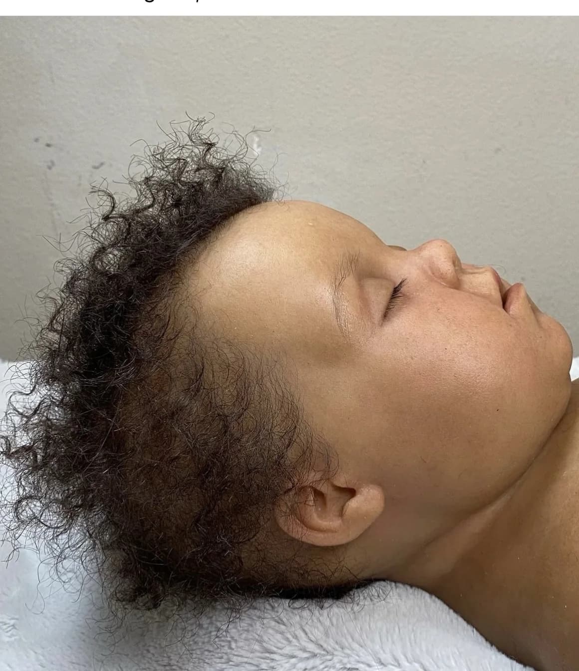 Hair Punching Study Profile